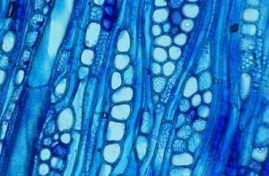 microscopic photo of cell parts blue hazed xylem